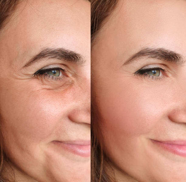 Seline Lymfatický Obličejový Kartáček