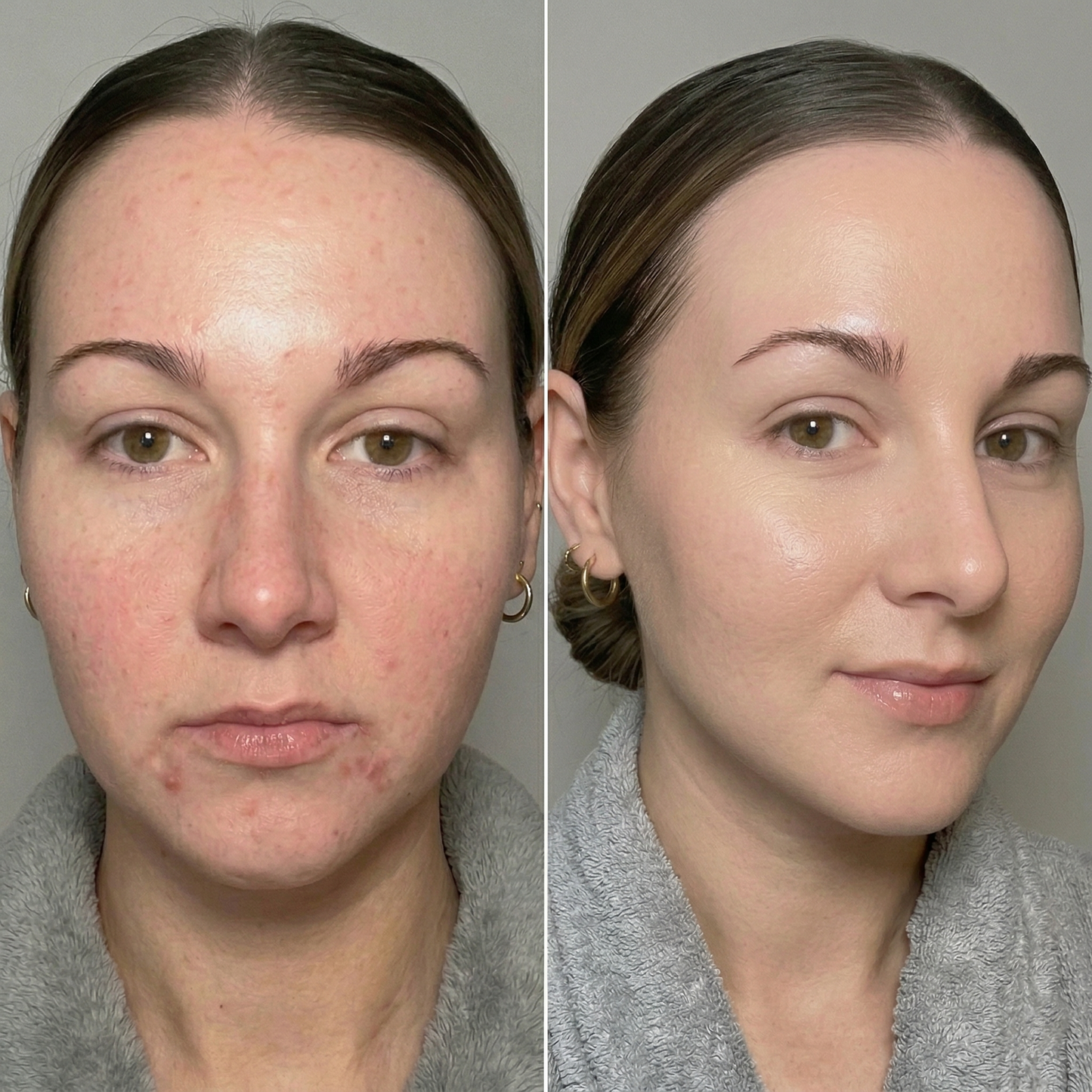 Seline Natural hydratační pleťové sérum