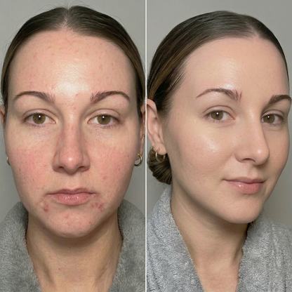 Seline Natural hydratační pleťové sérum